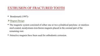 EXTRUSION OF FRACTURED TOOTH
• Bondemark (1997)-
Magnet Design
• The magnetic system consisted of either one or two cylindrical parylene- or stainless
steel-coated, neodymium-iron-boron magnets placed in the coronal part of the
remaining root.
• Attractive magnets have been used for orthodontic extrusion.
 