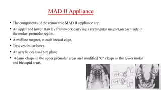 MAD II Appliance
• The components of the removable MAD II appliance are:
• An upper and lower Hawley framework carrying a rectangular magnet,on each side in
the molar- premolar region.
• A midline magnet, at each incisal edge.
• Two vestibular bows.
• An acrylic occlusal bite plane.
• Adams clasps in the upper premolar areas and modified "C" clasps in the lower molar
and bicuspid areas.
 