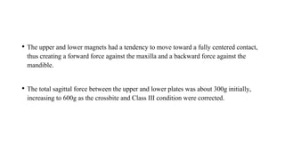 • The upper and lower magnets had a tendency to move toward a fully centered contact,
thus creating a forward force against the maxilla and a backward force against the
mandible.
• The total sagittal force between the upper and lower plates was about 300g initially,
increasing to 600g as the crossbite and Class III condition were corrected.
 