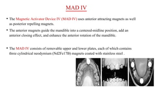 MAD IV
• The Magnetic Activator Device IV (MAD IV) uses anterior attracting magnets as well
as posterior repelling magnets.
• The anterior magnets guide the mandible into a centered-midline position, add an
anterior closing effect, and enhance the anterior rotation of the mandible.
• The MAD IV consists of removable upper and lower plates, each of which contains
three cylindrical neodymium (Nd2Fe17B) magnets coated with stainless steel .
 