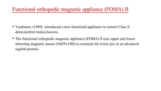 Functional orthopedic magnetic appliance (FOMA) II
• Vardimon, (1989) introduced a new functional appliance to correct Class ll
dentoskeletal malocclusions.
• The functional orthopedic magnetic appliance (FOMA) ll uses upper and lower
attracting magnetic means (Nd2Fe14B) to constrain the lower jaw in an advanced
sagittal posture.
 