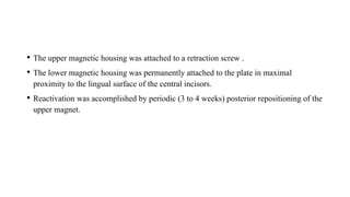 • The upper magnetic housing was attached to a retraction screw .
• The lower magnetic housing was permanently attached to the plate in maximal
proximity to the lingual surface of the central incisors.
• Reactivation was accomplished by periodic (3 to 4 weeks) posterior repositioning of the
upper magnet.
 
