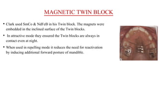 MAGNETIC TWIN BLOCK
• Clark used SmCo & NdFeB in his Twin block. The magnets were
embedded in the inclined surface of the Twin blocks.
• In attractive mode they ensured the Twin blocks are always in
contact even at night.
• When used in repelling mode it reduces the need for reactivation
by inducing additional forward posture of mandible.
 