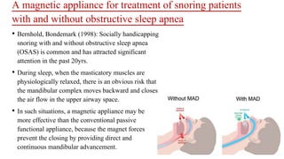 A magnetic appliance for treatment of snoring patients
with and without obstructive sleep apnea
• Bernhold, Bondemark (1998): Socially handicapping
snoring with and without obstructive sleep apnea
(OSAS) is common and has attracted significant
attention in the past 20yrs.
• During sleep, when the masticatory muscles are
physiologically relaxed, there is an obvious risk that
the mandibular complex moves backward and closes
the air flow in the upper airway space.
• In such situations, a magnetic appliance may be
more effective than the conventional passive
functional appliance, because the magnet forces
prevent the closing by providing direct and
continuous mandibular advancement.
 