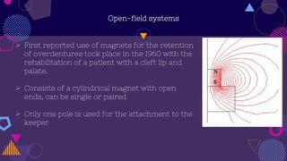 Open-field systems
 First reported use of magnets for the retention
of overdentures took place in the 1960 with the
rehabilitation of a patient with a cleft lip and
palate.
 Consists of a cylindrical magnet with open
ends, can be single or paired
 Only one pole is used for the attachment to the
keeper
 