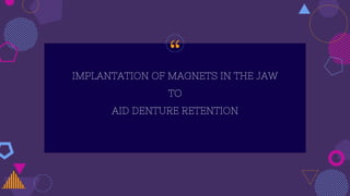 “IMPLANTATION OF MAGNETS IN THE JAW
TO
AID DENTURE RETENTION
 