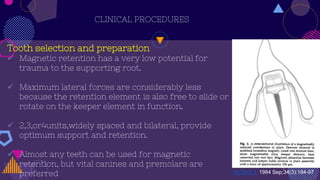 CLINICAL PROCEDURES
Tooth selection and preparation
 Magnetic retention has a very low potential for
trauma to the supporting root.
 Maximum lateral forces are considerably less
because the retention element is also free to slide or
rotate on the keeper element in function.
 2,3,or4units,widely spaced and bilateral, provide
optimum support and retention.
 Almost any teeth can be used for magnetic
retention, but vital canines and premolars are
preferred Int Dent J. 1984 Sep;34(3):184-97
 