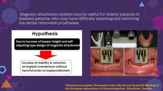 Magnetic attachment system may be useful for elderly patients or
disabled patients, who may have difficulty inserting and removing
the dental removable prostheses.
Richard Leesungbok ,Presented at the 24th Annual Scientific Meeting of
the European Association of Osseointegration, Stockholm, Sweden
 