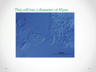 This cell has a diameter of 85µm
 