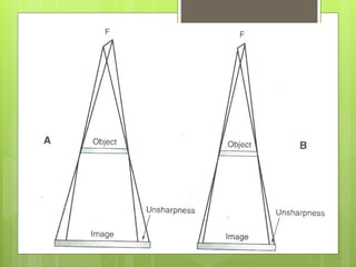 Comprehensive Guide to Radiographic Magnification and Image Distortion ...