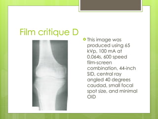 Comprehensive Guide to Radiographic Magnification and Image Distortion ...