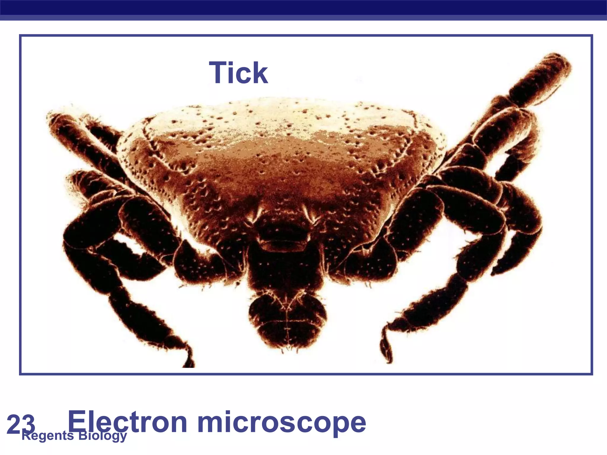 Tick 
Regents Biology 23 Electron microscope 
 