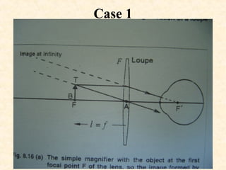 Case 1
 