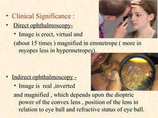 • Clinical Significance :
• Direct ophthalmoscopy-
• Image is erect, virtual and
(about 15 times ) magnified in emmetrope ( more in
myopes less in hypermetropes).
• Indirect ophthalmoscopy -
• Image is real ,inverted
and magnified , which depends upon the dioptric
power of the convex lens , position of the lens in
relation to eye ball and refractive status of eye ball.
 