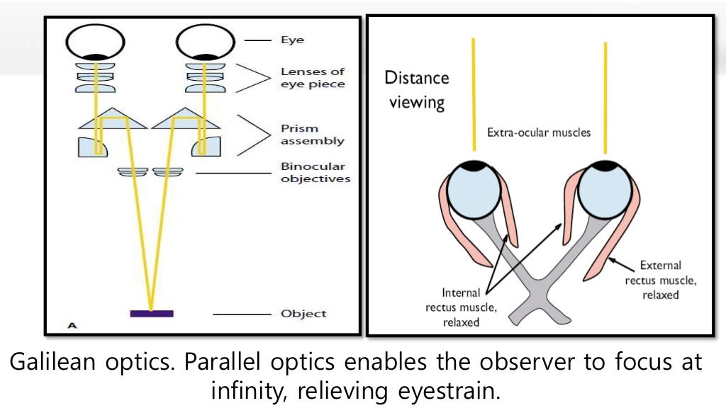 Magnification in endodontics by dr jagadeesh kodityala