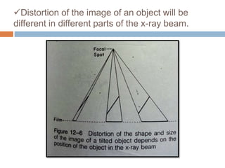 Distortion of the image of an object will be
different in different parts of the x-ray beam.
 