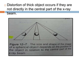  Distortion of thick object occurs if they are
not directly in the central part of the x-ray
beam.
 