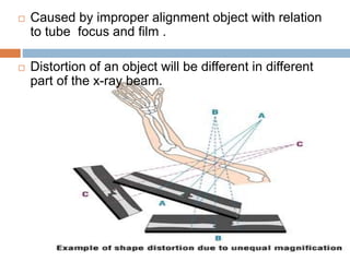  Caused by improper alignment object with relation
to tube focus and film .
 Distortion of an object will be different in different
part of the x-ray beam.
 