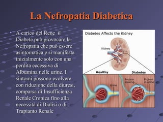 La Nefropatia Diabetica
• A carico del Rene il
Diabete può provocare la
Nefropatia che può essere
asintomatica e si manifesta
inizialmente solo con una
perdita eccessiva di
Albumina nelle urine. I
sintomi possono evolvere
con riduzione della diuresi,
comparsa di Insufficienza
Renale Cronica fino alla
necessità di Dialisi o di
Trapianto Renale

 