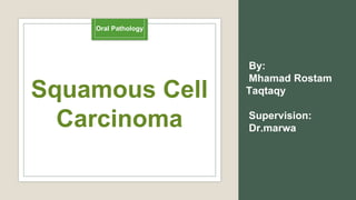 Squamous Cell
Carcinoma
By:
Mhamad Rostam
Taqtaqy
Supervision:
Dr.marwa
Oral Pathology
 