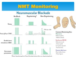 Nmt Monitor Mahareak myasthenia | PPTX