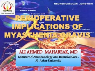 PERIOPERATIVE
IMPLICATIONS OF
MYASTHENIA GRAVIS
ALI AHMED MAHAREAK, MD
Lecturer Of Anesthesiology And Intensive Care ,
Al-Azhar University
 