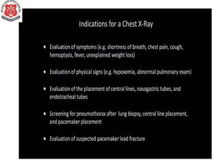 Chest X Ray INTERPRETATION IN PEDIATRICS.pptx