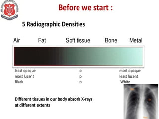 Chest X Ray INTERPRETATION IN PEDIATRICS.pptx