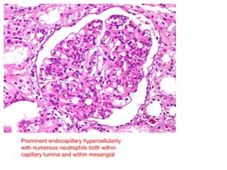 Histology and pathology of renal system.pptx
