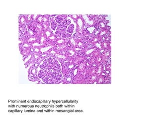 Histology and pathology of renal system.pptx