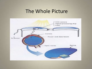 bionic eye | PPT