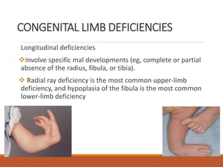 Mahi congenital | PPTX