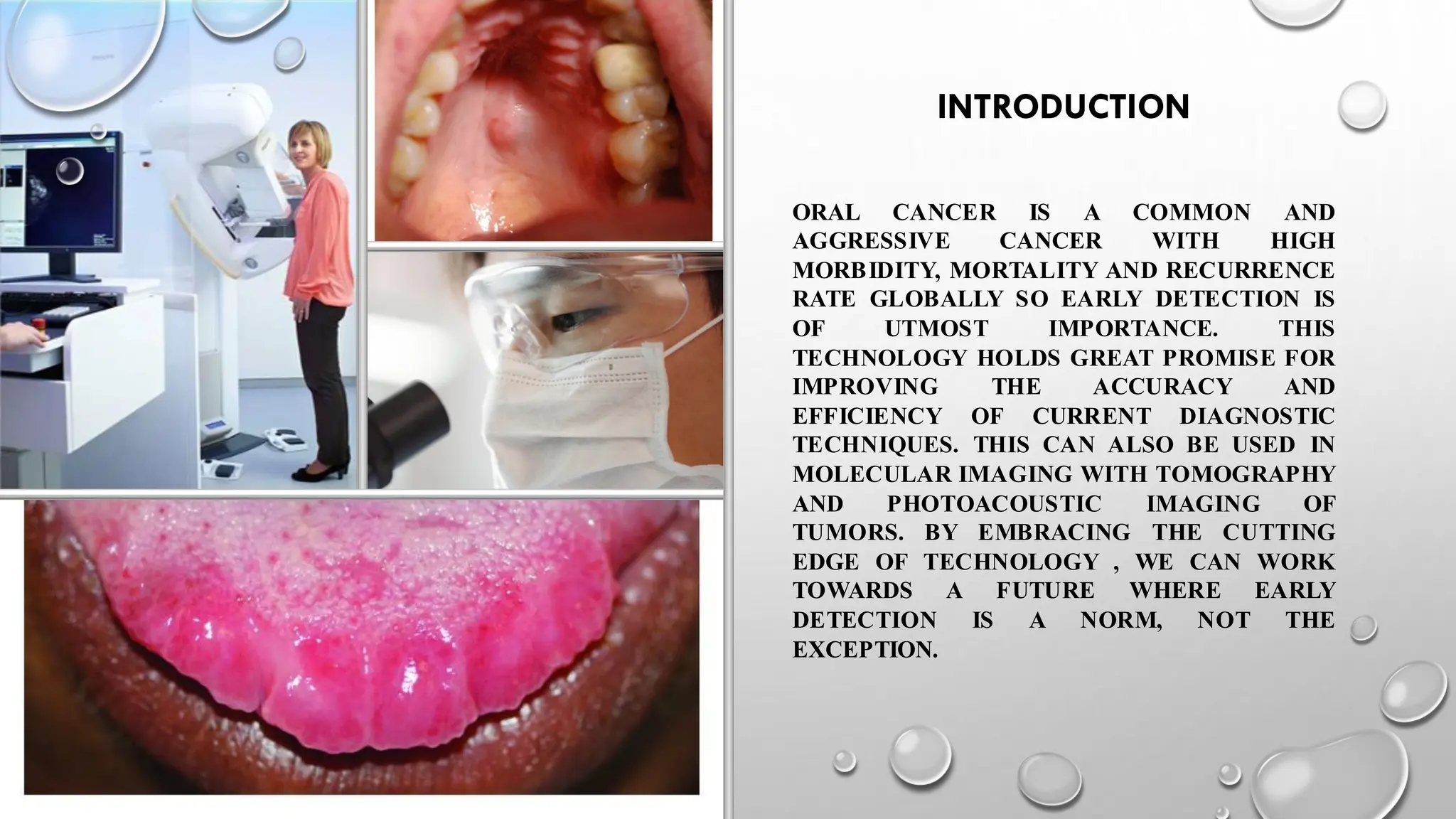 Nanotechnology in Oral cancer - A boon to the diagnosis | PDF