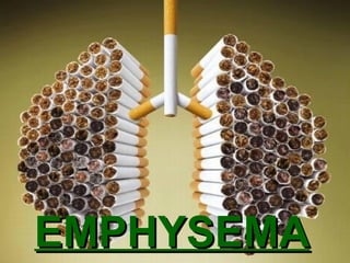 EMPHYSEMA

 