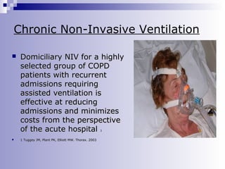 Chronic Non-Invasive Ventilation


Domiciliary NIV for a highly
selected group of COPD
patients with recurrent
admissions requiring
assisted ventilation is
effective at reducing
admissions and minimizes
costs from the perspective
of the acute hospital
1



1 Tuggey JM, Plant PK, Elliott MW. Thorax. 2003

 
