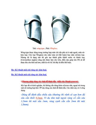 Re: Kỹ thuật mài cùi răng sứ- kim loại.
Re: Kỹ thuật mài cùi răng sứ- kim loại.
 