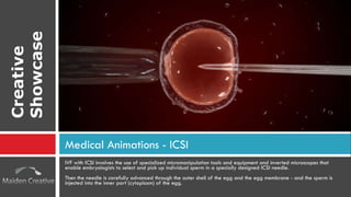 IVF with ICSI involves the use of specialized micromanipulation tools and equipment and inverted microscopes that enable embryologists to select and pick up individual sperm in a specially designed ICSI needle. Then the needle is carefully advanced through the outer shell of the egg and the egg membrane - and the sperm is injected into the inner part (cytoplasm) of the egg. Medical Animations - ICSI Creative Showcase 