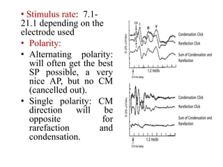 Mai EchoG and OAEs ENT [Recovered].pptx