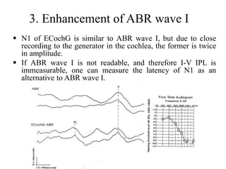 Mai EchoG and OAEs ENT [Recovered].pptx