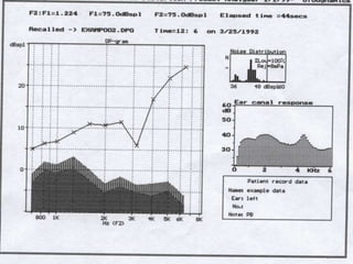 Mai EchoG and OAEs ENT [Recovered].pptx