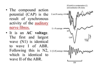 Mai EchoG and OAEs ENT [Recovered].pptx