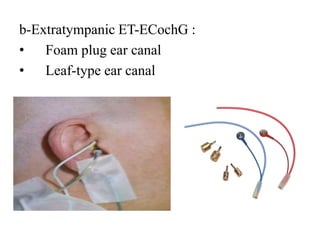 Mai EchoG and OAEs ENT [Recovered].pptx
