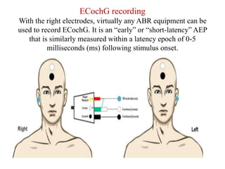 Mai EchoG and OAEs ENT [Recovered].pptx