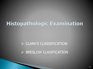 Mailgnant melanoma | PPTX
