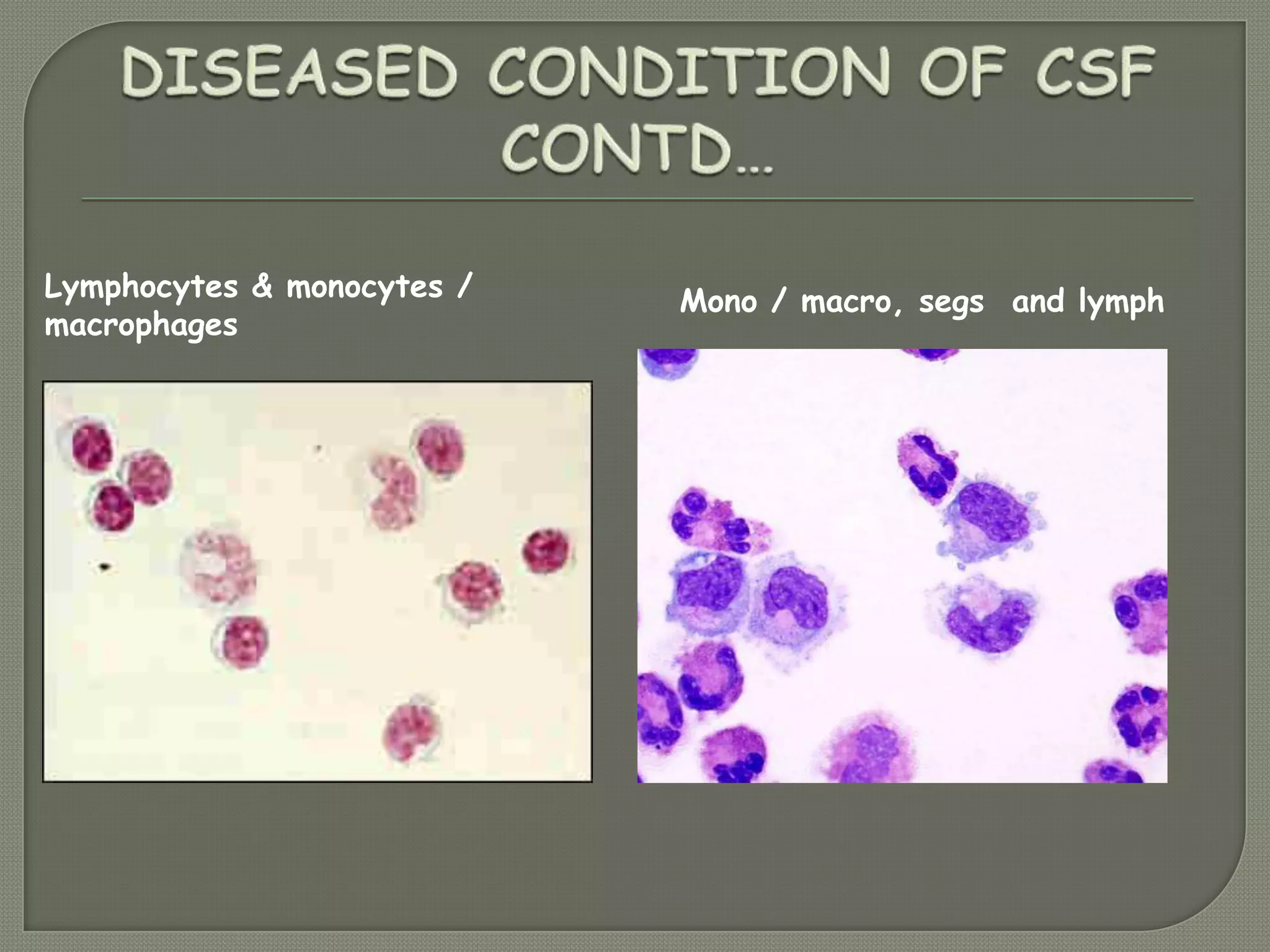 Lymphocytes & monocytes /
macrophages
Mono / macro, segs and lymph
 