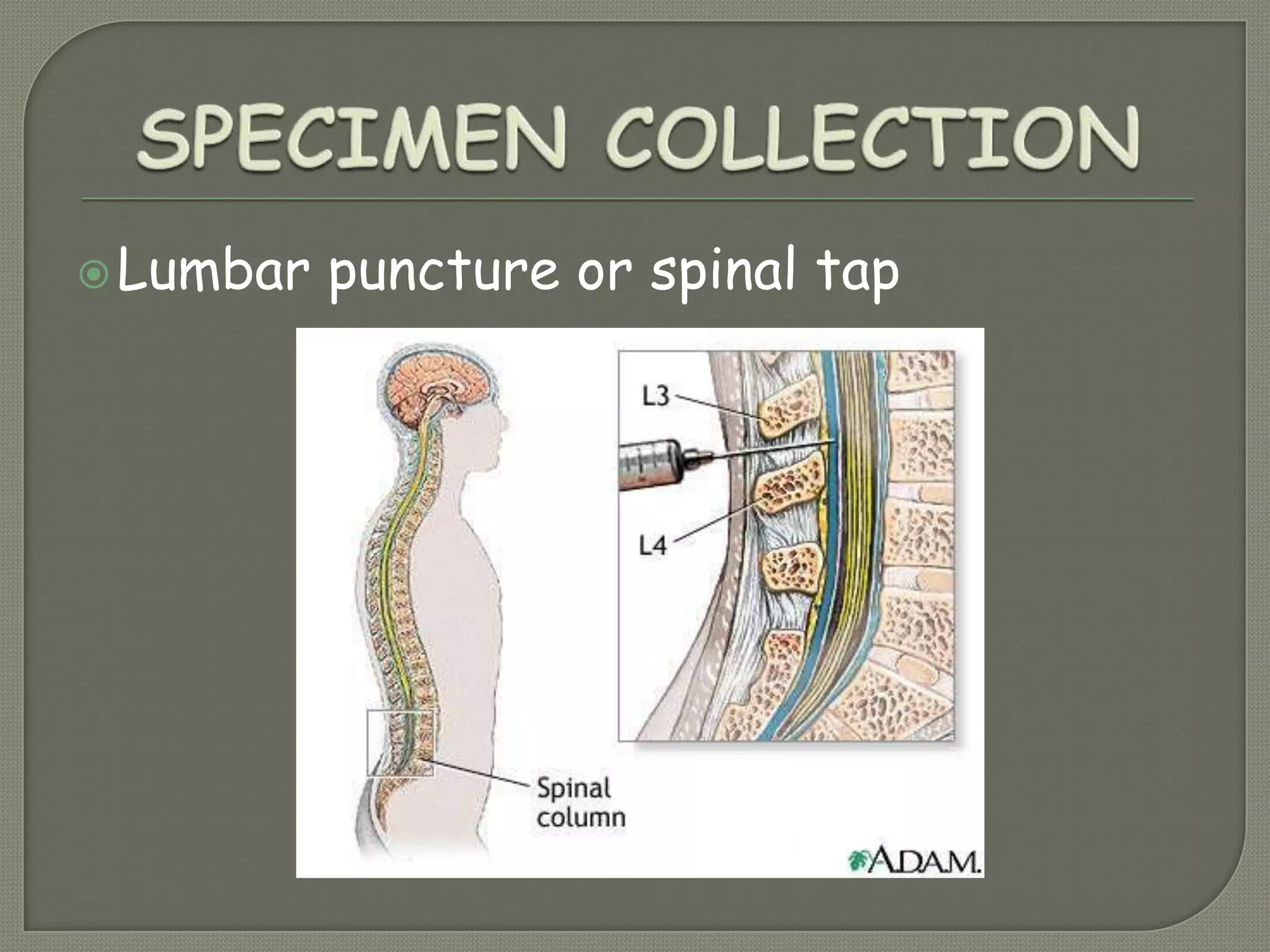 Lumbar puncture or spinal tap
 