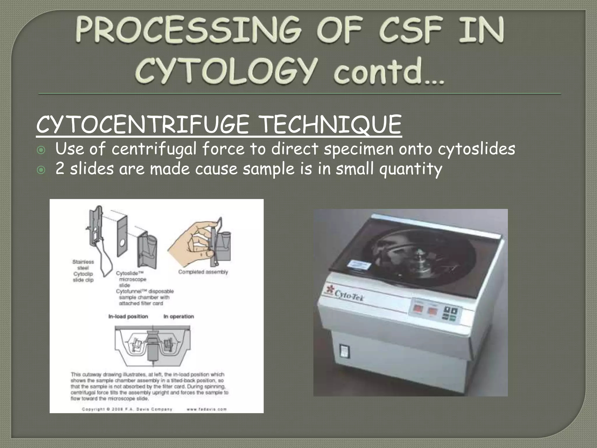 CYTOCENTRIFUGE TECHNIQUE
 Use of centrifugal force to direct specimen onto cytoslides
 2 slides are made cause sample is in small quantity
 