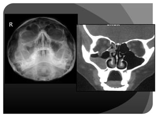 Imaging in Ocular Pathologies | PPTX