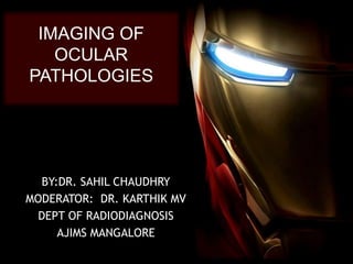 IMAGING OF
OCULAR
PATHOLOGIES
BY:DR. SAHIL CHAUDHRY
MODERATOR: DR. KARTHIK MV
DEPT OF RADIODIAGNOSIS
AJIMS MANGALORE
 