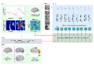 Activations of deep convolutional neural networks are aligned with gamma band activity of human visual cortex